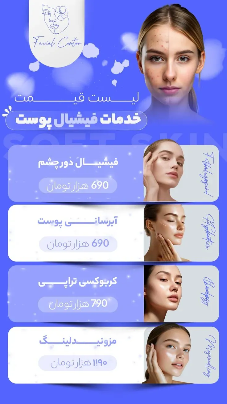 نمونه استوری ثابت 3